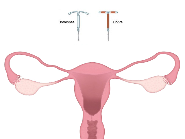 uterus-g89ab11589_640.jpg viefem.jpg viefem